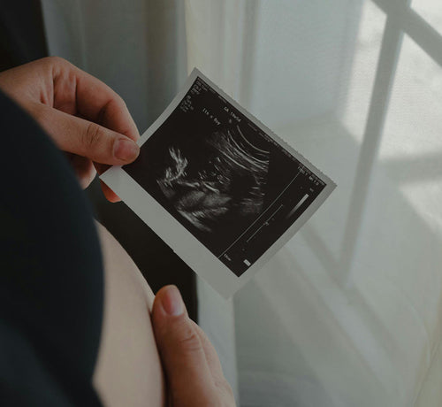 Echographie à 3 mois de grossesse - Mustela France - 1
